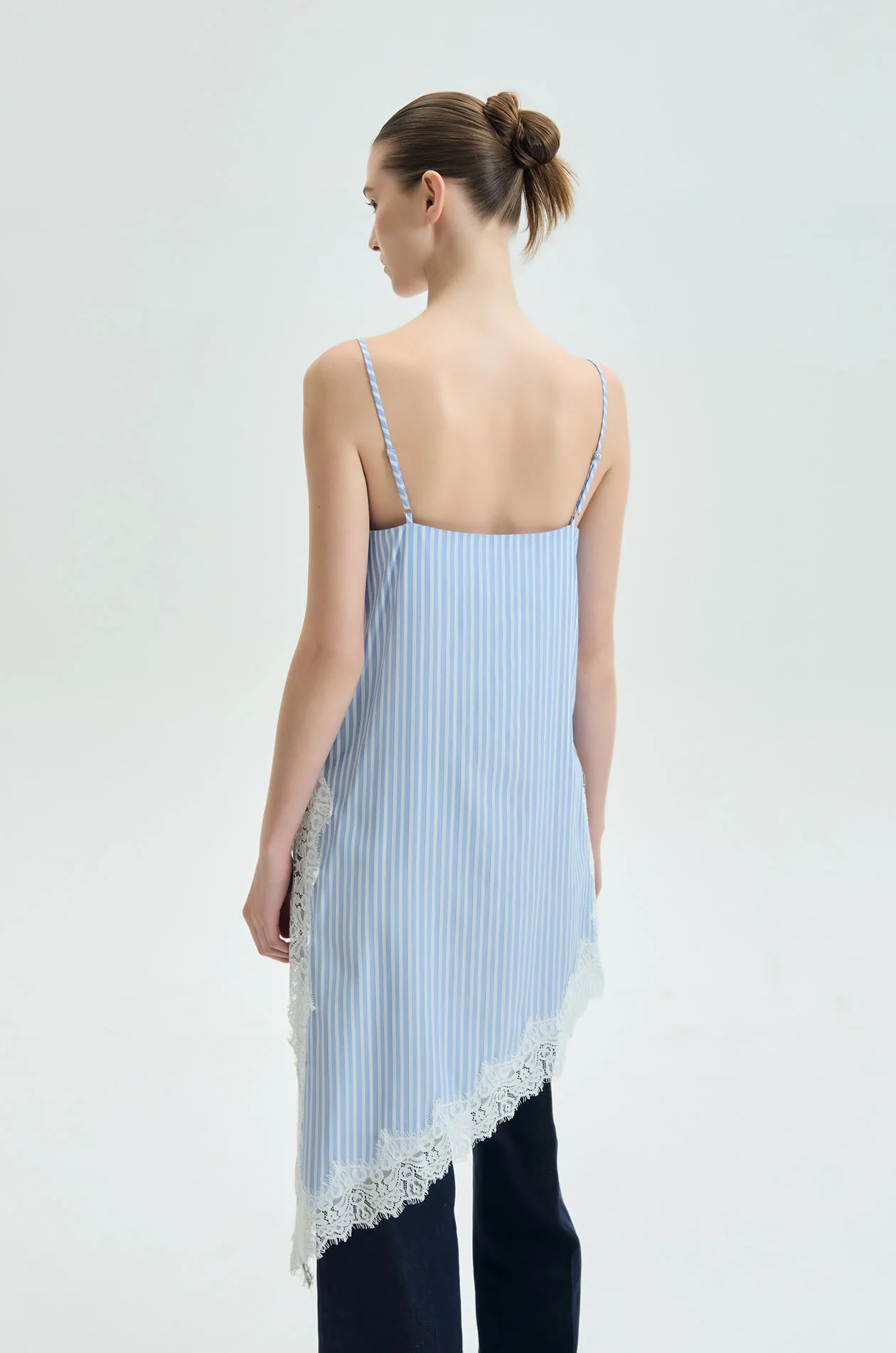 Striped Lace-Trim Tunic Top - Image 5